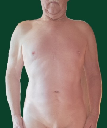 zurück